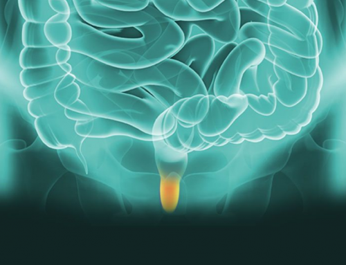 Perianal Fistül Lazer Tedavisi (Ameliyatı)