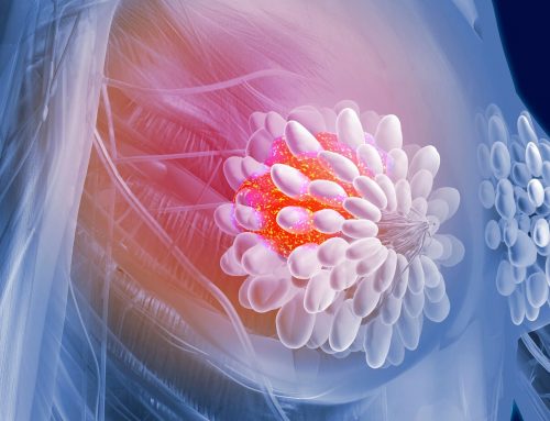 Meme Kanseri Nasıl Anlaşılır?