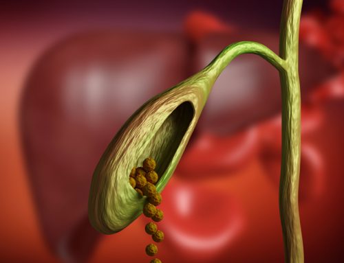 Ataşehir Safra Kesesi Cerrahisi – Tedavisi – Doktoru